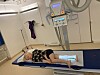 Melker röntgas för att se om skelettet är inflammerat.