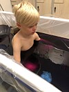 Melker har behandlats för sina i eksem i lilafärgade bad som innehåller kaliumpermanganat.