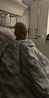 En riktigt låg punkt 2019. Svampen tryckte på lungorna och gjorde att syreupptagningen blev sämre. Amanda behövde syremask.