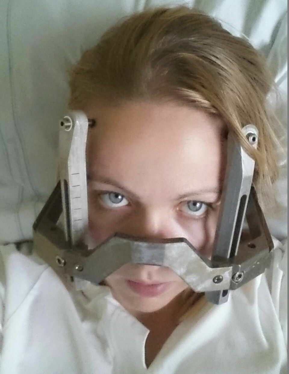 Maja hade drabbats av en stor blödning i hjärnan, ett så kallat AVM. Foto: Privat Maja hade drabbats av en stor blödning i hjärnan, ett så kallat AVM. Foto: Privat