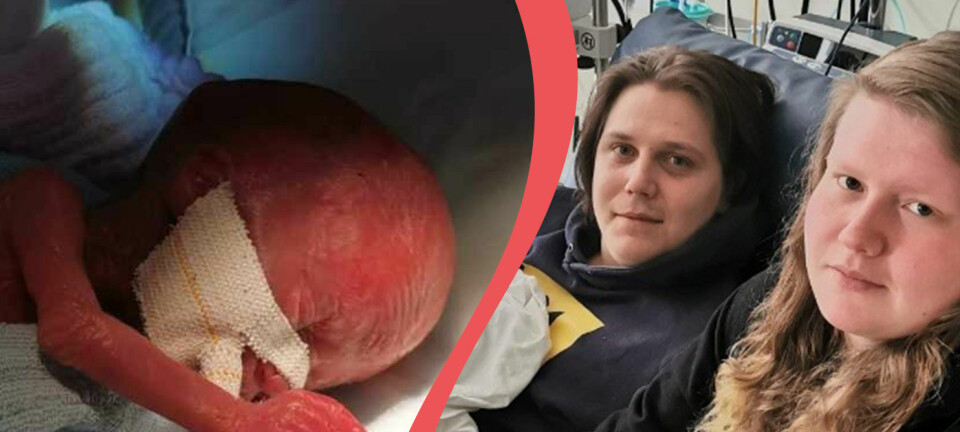 Luna är Sveriges minsta överlevande bebis: Vägde 269 gram