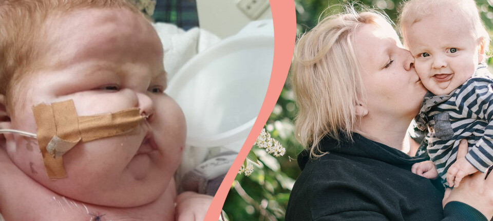 Walders tuffa start i livet – föddes med dödlig sjukdom