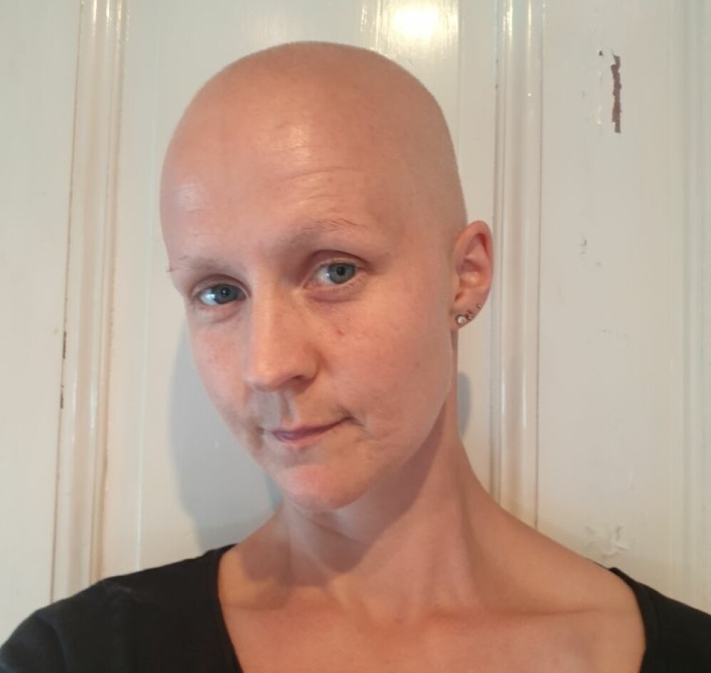 Den här bilden togs när Matilda befann sig i mitten av en av många cellgiftsbehandlingar. ”Jag var trött och sliten. Men jag visste att det fungerade, att tumörerna krympte och att jag äntligen fått min vilja igenom om att ta bort båda brösten”, säger hon. Den här bilden togs när Matilda befann sig i mitten av en av många cellgiftsbehandlingar. ”Jag var trött och sliten. Men jag visste att det fungerade, att tumörerna krympte och att jag äntligen fått min vilja igenom om att ta bort båda brösten”, säger hon.