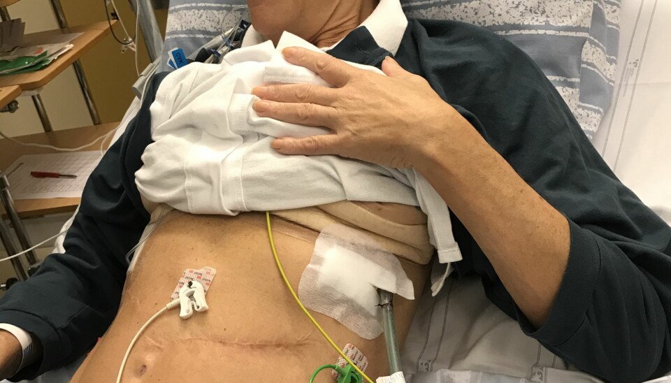Madeleine två veckor efter operationen. Madeleine två veckor efter operationen.