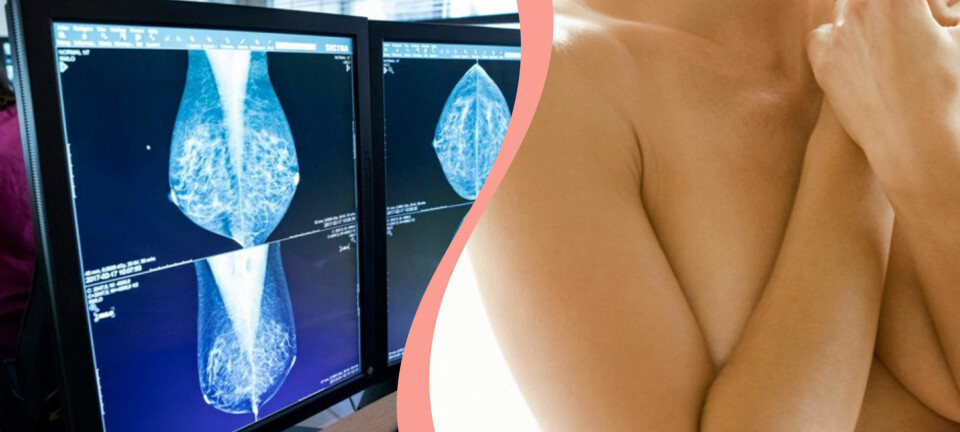 En av fem kvinnor går inte på mammografi