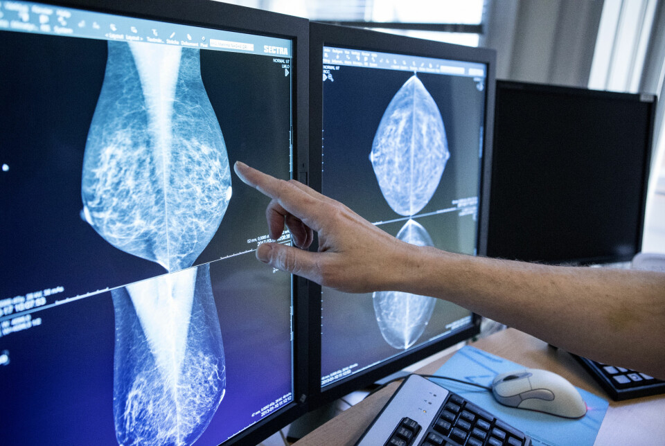 Så många kvinnor drabbas av bröstcancer varje år