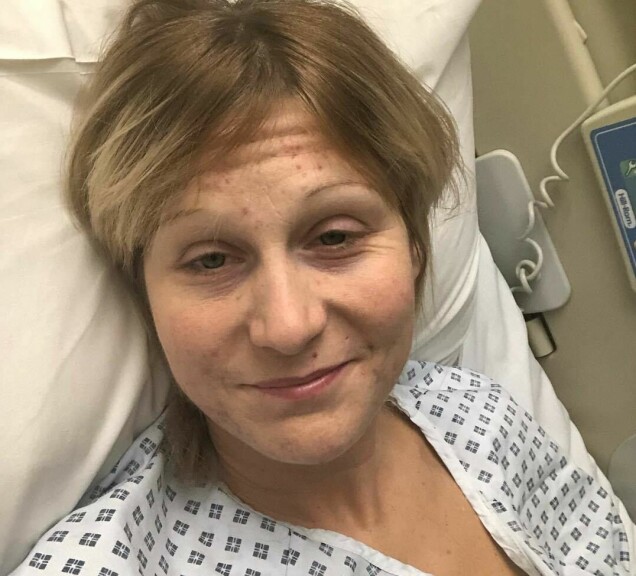Karin efter operationen 2018. Karin efter operationen 2018.