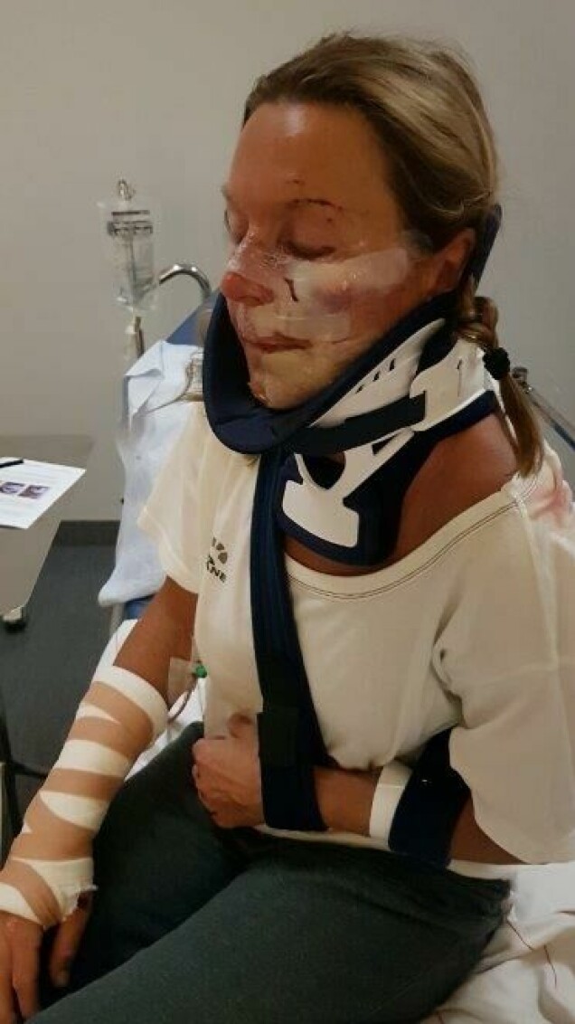 Pia skadade sig rejält i samband med cykelolyckan. Pia skadade sig rejält i samband med cykelolyckan.
