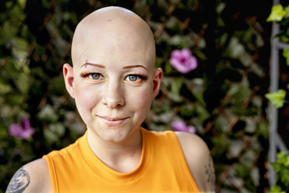 Lena har valt att vara öppen om sin alopeci. Lena har valt att vara öppen om sin alopeci.