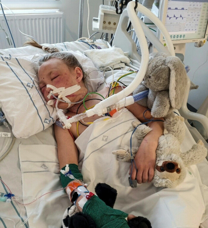 På IVA. Strypvåldet fick halsen att svälla och för att säkerställa fria luftvägar behövde man intubera och koppla Luna till en respirator. Hon var sövd från och till i elva dygn. 9-åriga Luna ligger på IVA och är kopplad till en respirator.