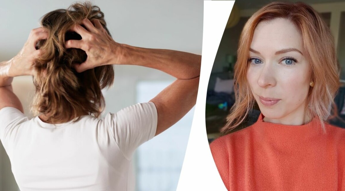 Så blev jag av med min kliande hårbotten och fick babyhåren att växa ut – budgettipset funkade