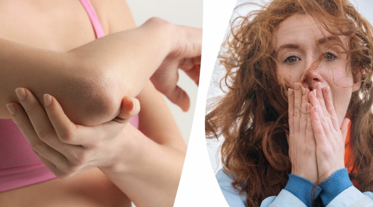 Så får du bukt med dina torra armbågar – oväntade husmorstipset gör jobbet