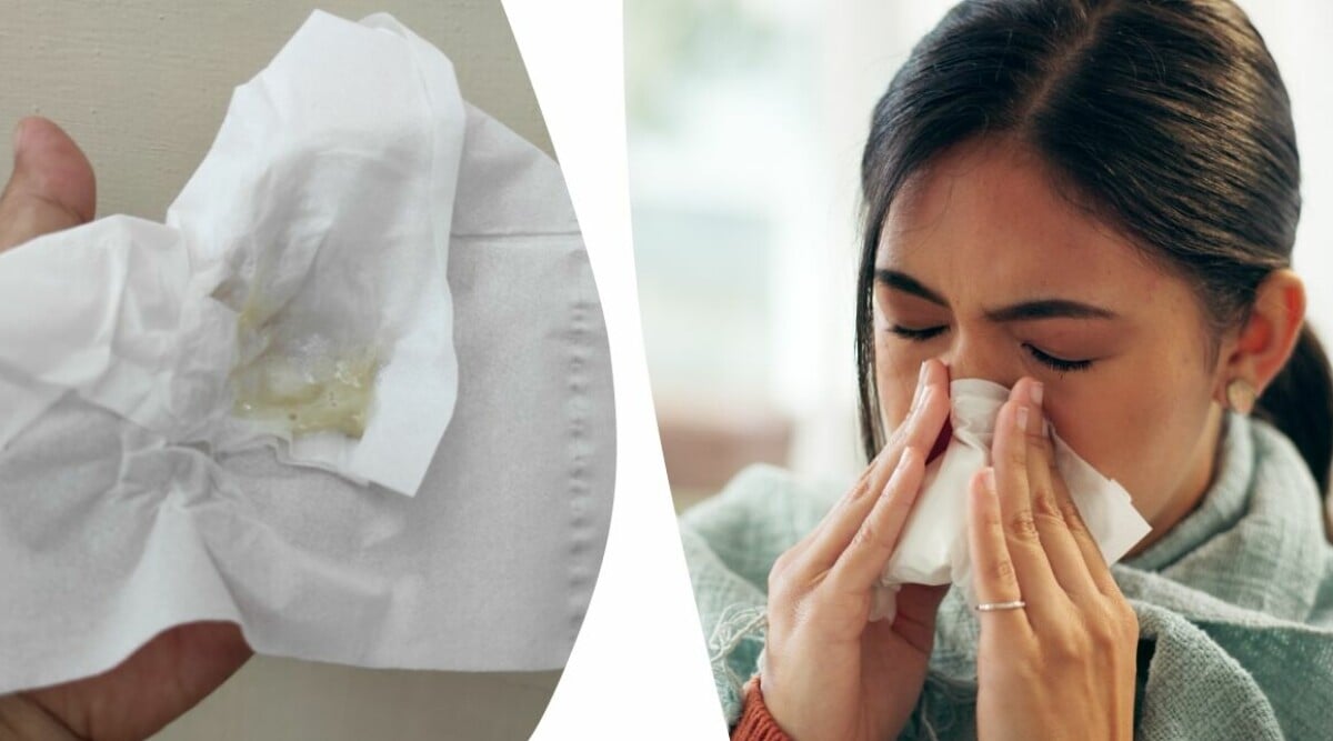 Snorets färg kan vara tecken på sjukdom – då bör du söka vård