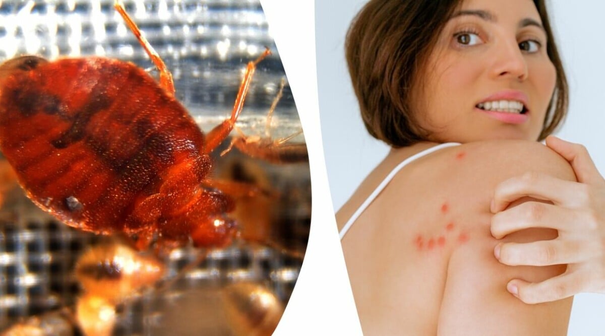 Skadedjursexperten: 5 tecken på att du har vägglöss hemma – då behöver du agera lockbete