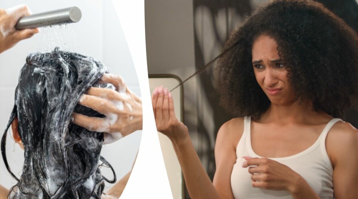 Hudläkarens varning – detta händer om du tvättar håret för sällan: ”Försämrar besvären”