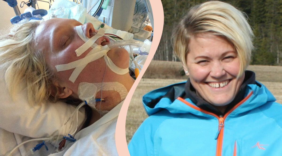 Åsa har haft två hjärnblödningar: ”Det kändes som om huvudet exploderade”