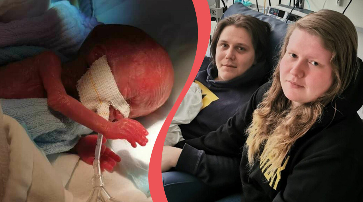 Luna är Sveriges minsta överlevande bebis: Vägde 269 gram