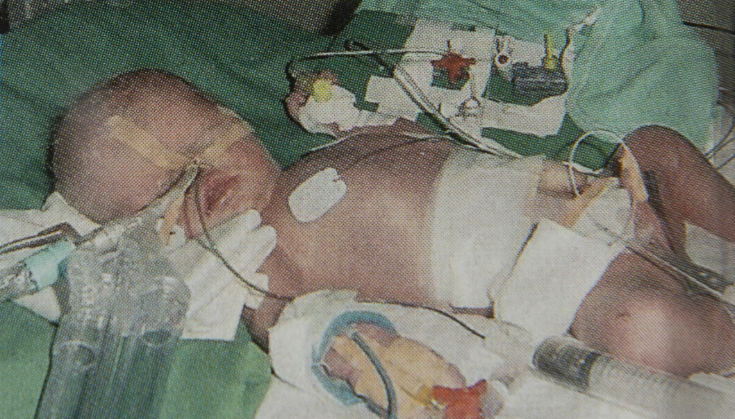 Adam skadades också av kniven som gick rakt igenom mamma Vicktorias livmoder, och fick vårdas på sjukhus. Foto: Privat Adam, som knivskars när han låg i sin mammas mage, vårdas på sjukhus.