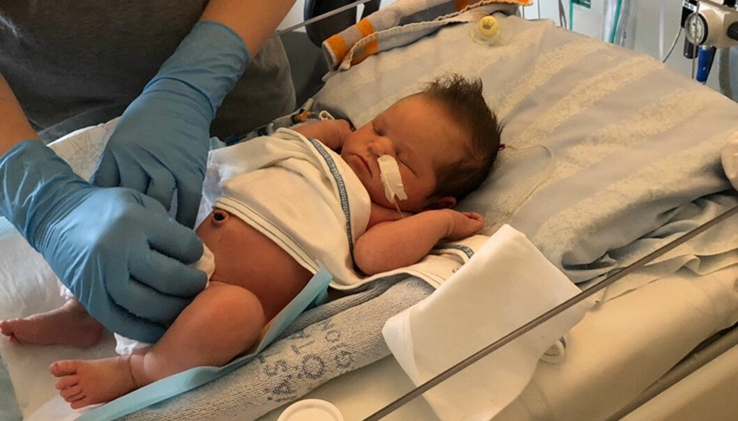 Under behandlingarna fick Alice ett cellgift så starkt att hennes föräldrar tvingades ha handskar när de tog hand om henne. Foto: Privat Alice Ström behandlad med cellgifter för sin leukemi.