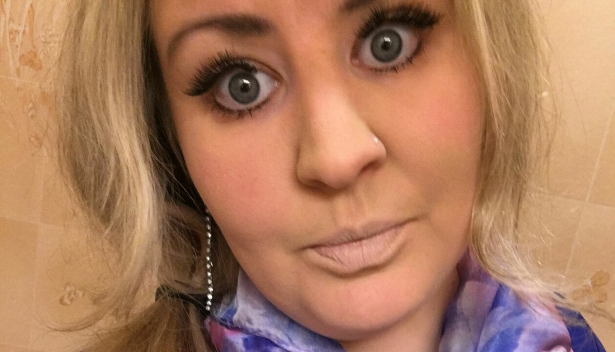 Anledningen till varför Heidi fick en hjärtinfarkt tros vara genetisk, då både hennes pappa och farmor också haft hjärtfel. En ansiktsbild av Heidi Mattsson där hon tittar in i kameran.