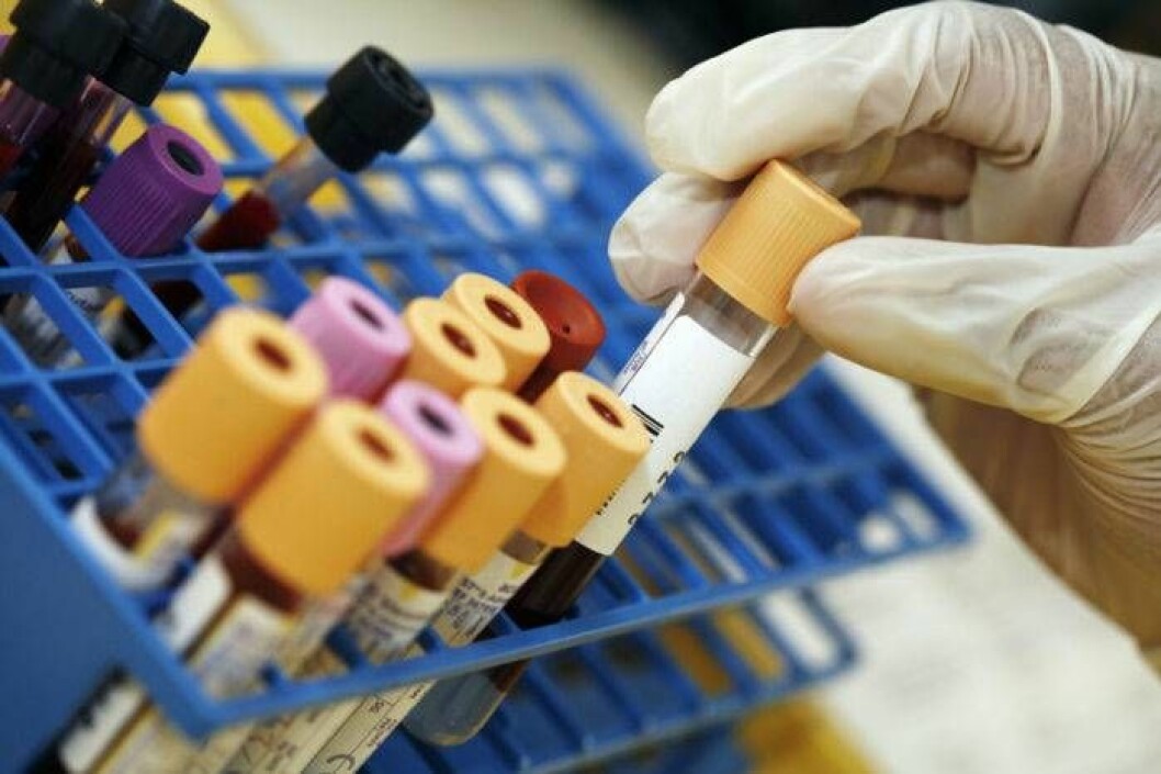 Ett enkelt laboratorieprov kan, i kombination med röntgen, avslöja om patienten har NET. Bild: IBL Ett enkelt laboratorieprov kan, i kombination med röntgen, avslöja om patienten har NET.