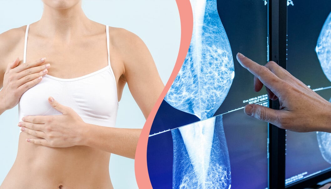 Till vänster, kvinna känner på ena bröstet, till höger, en röntgenläkare tittar på bilder.