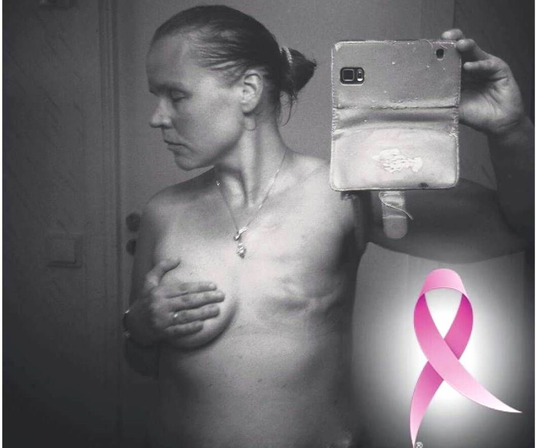 Charlottas angripna bröst opererades bort 2012 och några år senare opererade hon bort även det andra bröstet för säkerhets skull. Foto: Privat Charlotta tar en selfie för Rosa bandet
