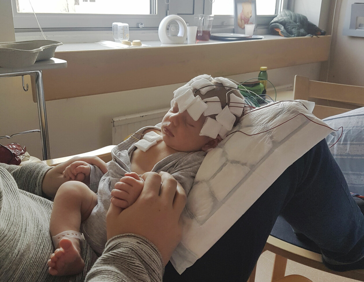 På sjukhuset fick Elton genomgå många undersökningar av hjärnan. Det visade sig att han har Ohtaharas syndrom. Elton ligger hos pappa Tom med hela huvudet inklätt i slattar och undersökningsutrustning.