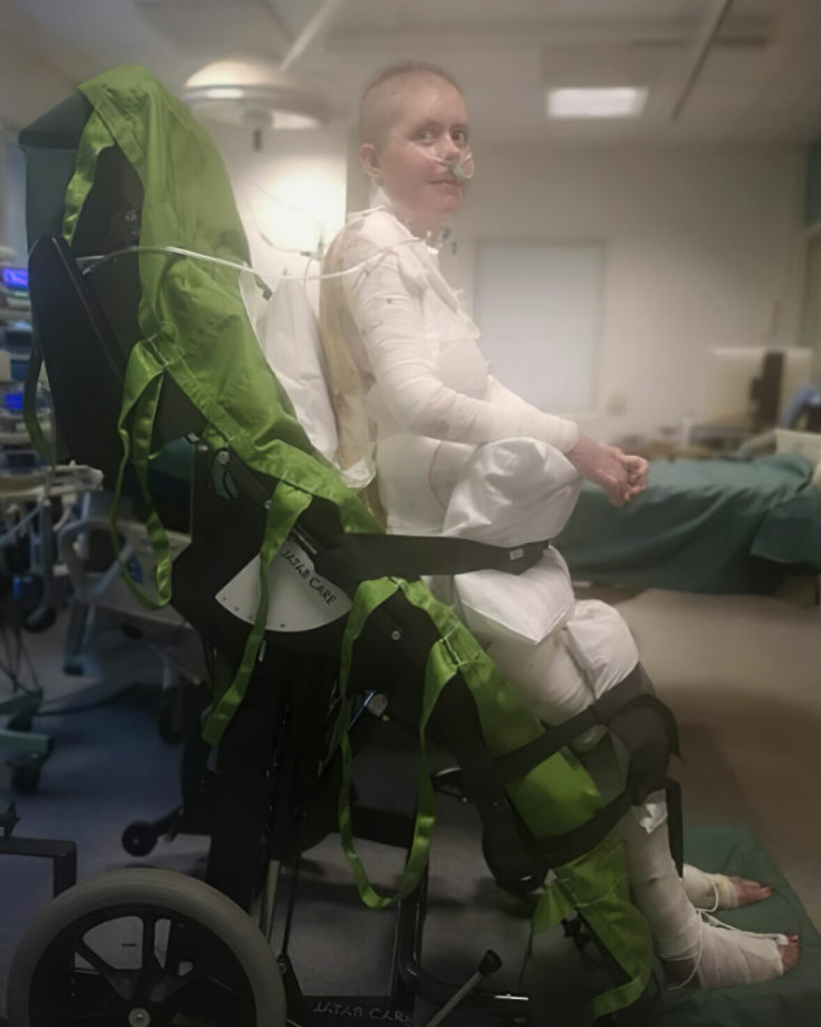 Emma Schols lever än i dag med svåra smärtor – men har trots allt återhämtat sig mirakulöst fort. Emma Shols blev av med sitt hår och stora delar av hennes hud försvann i infernot.