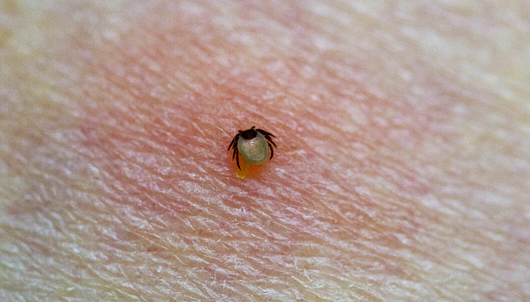En fästing som bitit sig fast i huden som blivit röd.