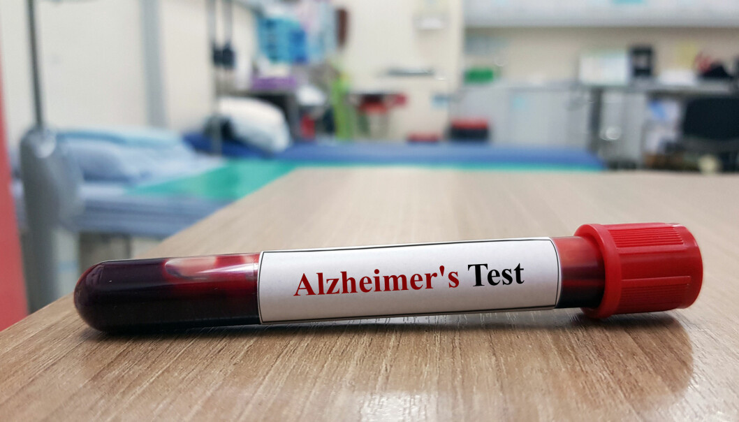 Ett enkelt blodprov ska i framtiden räcka för att diagnosticera personer med Alzheimers sjukdom, hoppas forskare vid Lunds universitet. Foto: Shutterstock/TT Ett blodprov med en lapp där det står "Alzheimer's test".