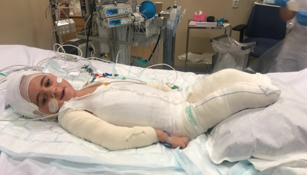 Läkarna tvingades amputera den lillas båda fötter. Gabriella i sjukhussäng med nyamputerade fötter.