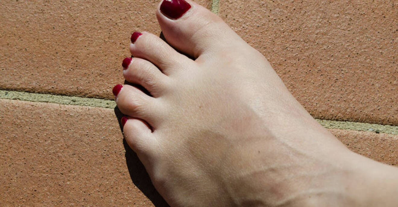 Tips för att slippa svullna fötter i sommarvärmen.