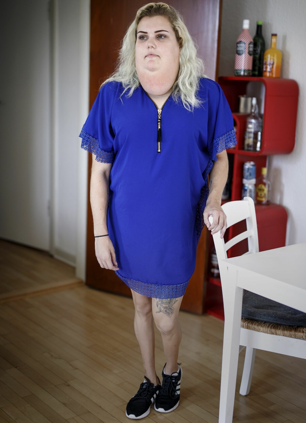 Julie startade en blogg för att berätta om hur det är att leva med sjukdomen hon har, familjär partiell lipodystrofi. Foto: Gregers Kirdorf Julie, som har familjär partiell lipodystrofi, står i sitt hem iklädd en blå klänning.