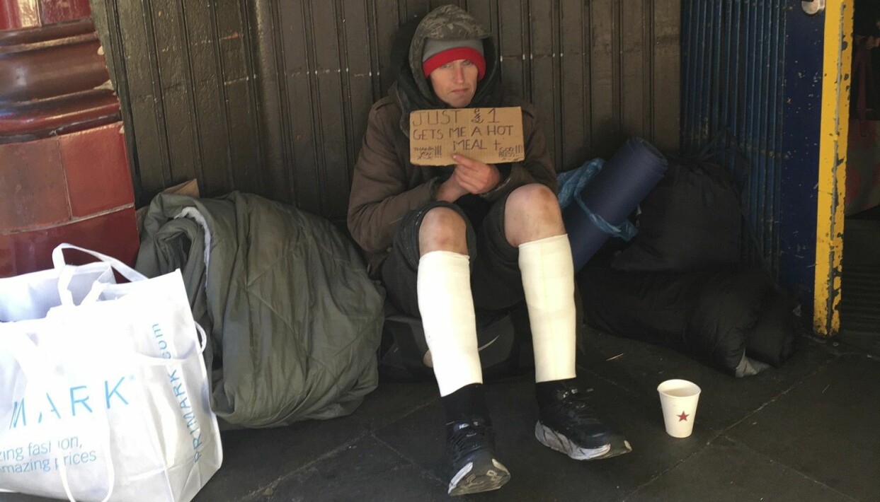 När Ulrika och Johan hittade James kretsade hela hans liv kring att tigga ihop tillräckligt varje dag för att kunna stilla sitt heroinbehov. Foto: Privat James sitter ute på gatorna i London med lindade ben.