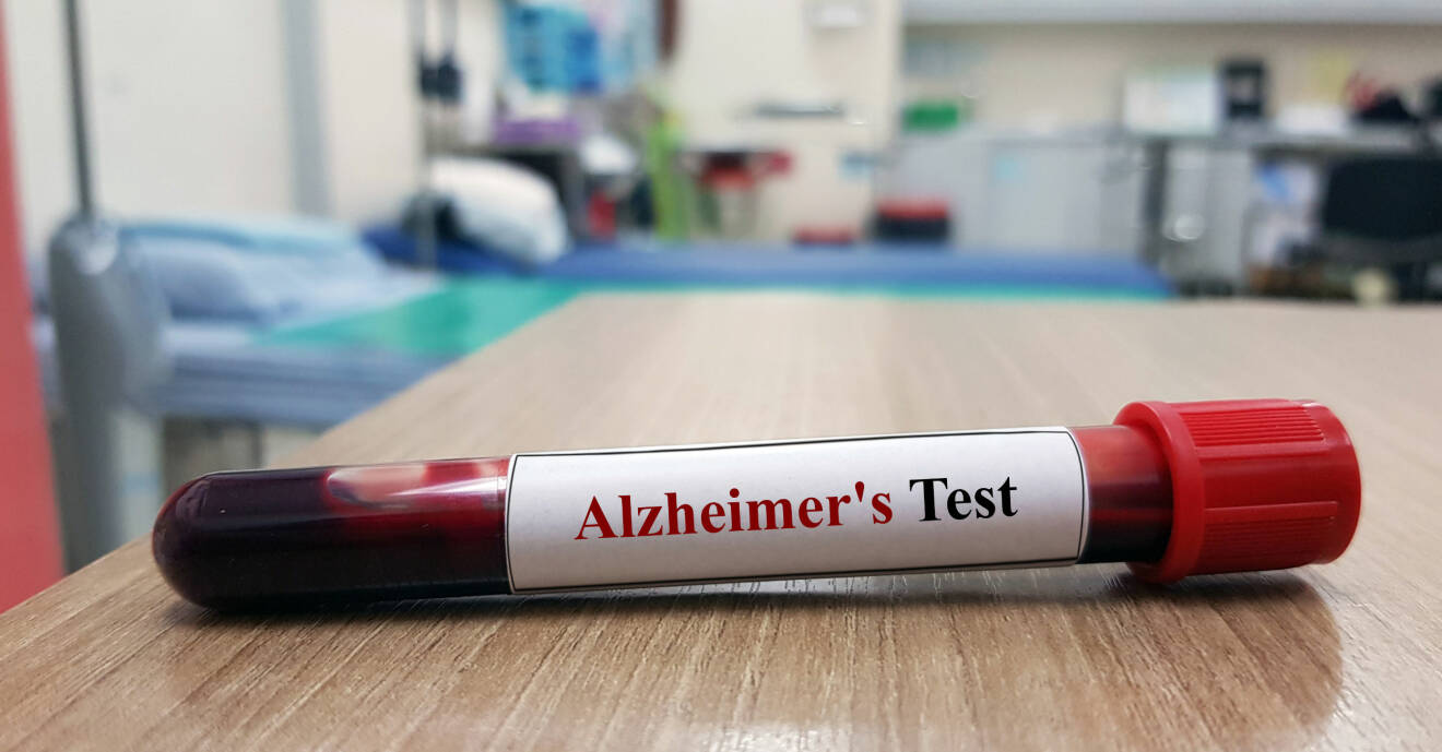 Ett blodprov med en lapp där det står "Alzheimer's test".