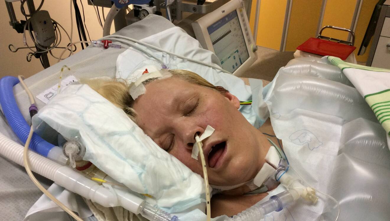 Åsa ligger nedsövd på sjukhus med en slang i näsan.