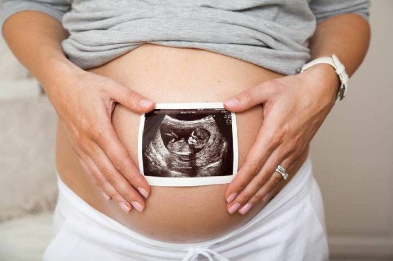 En gravid kvinna med sin ultraljudsbild framför magen