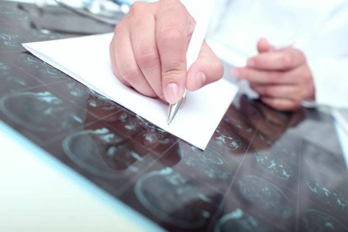 Läkare skriver på papper ovanpå en röntgenplåt över hjärnor.