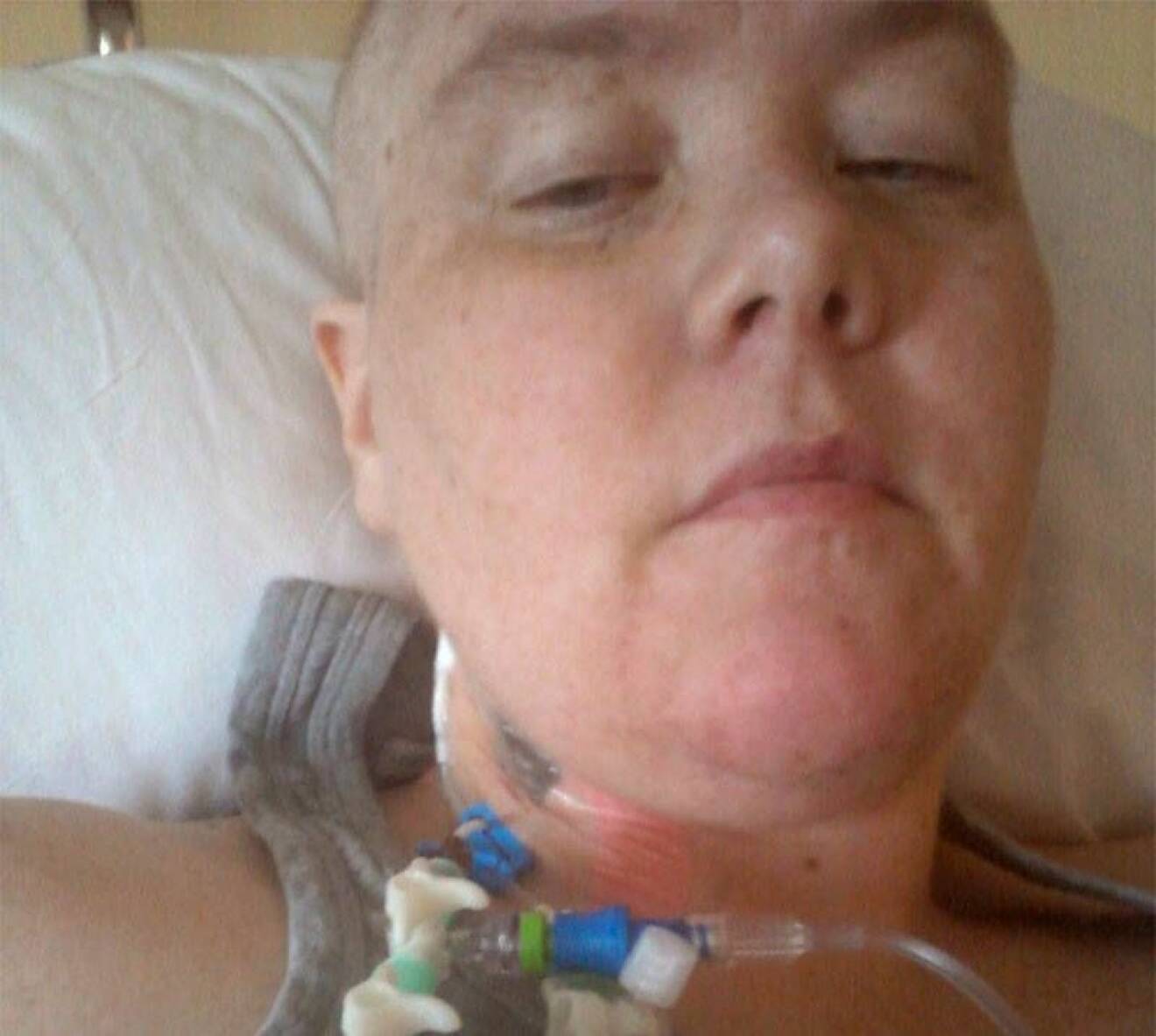 Jessica Bergs genomgick en stamcellstransplantation 2012