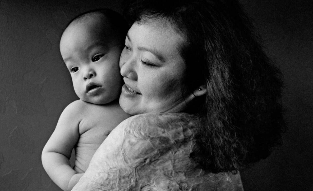 Brännskadade Kim Phuc håller sin nyfödde son Thomas.