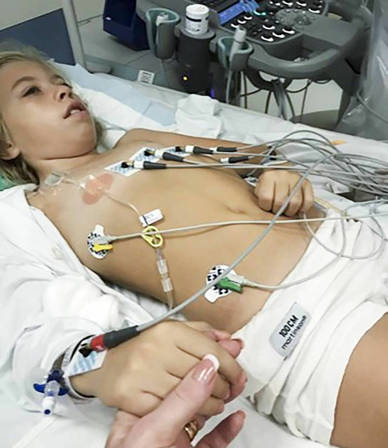 Lilla Ida ligger i en sjukhussäng med slangar kopplade i kroppen