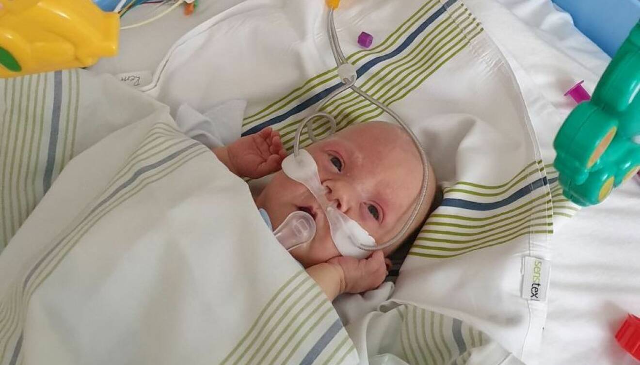 En liten bebis med syrgasslangar i näsan i en sjukhussäng.
