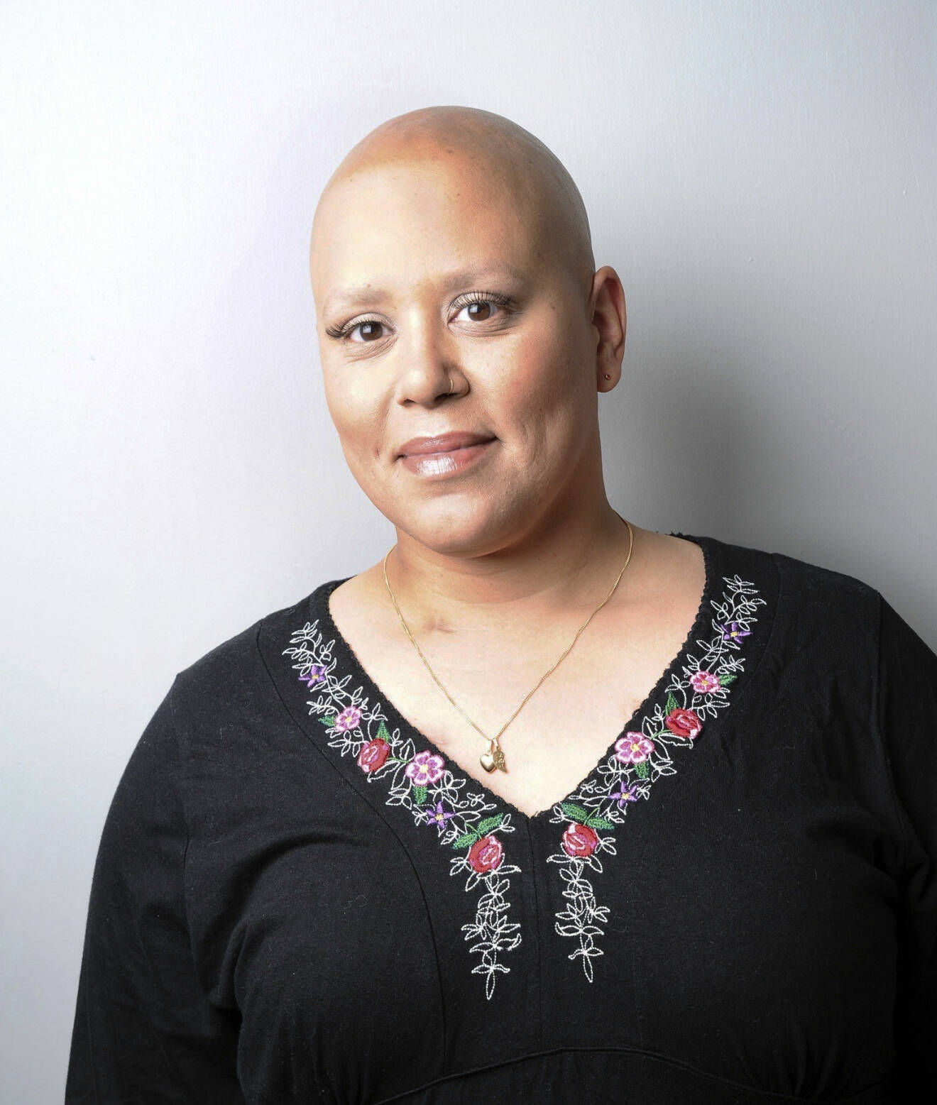 Kim Bornholm med helt rakat huvud efter hennes andra cancerbehandling.