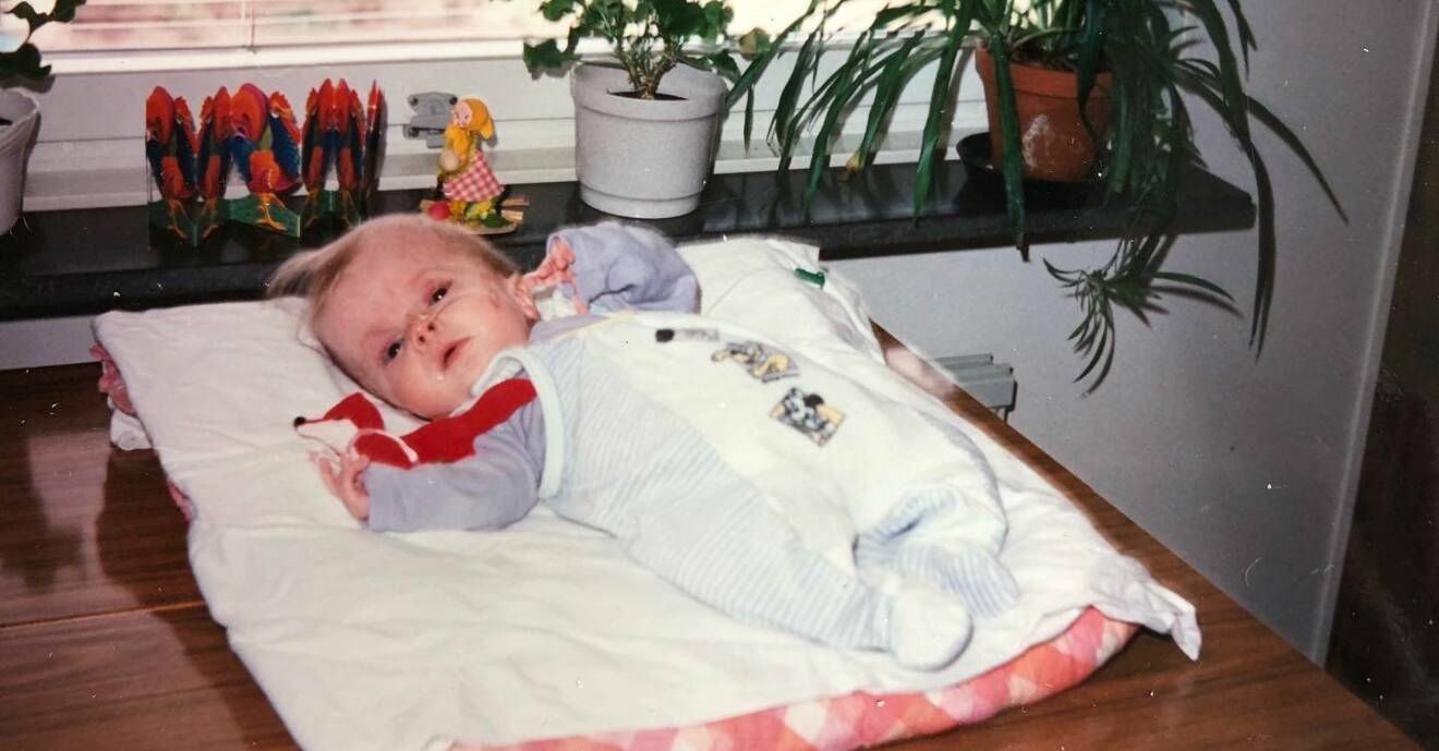 Louise Vidlund som spädbarn, hon föddes med svår benskörhet.