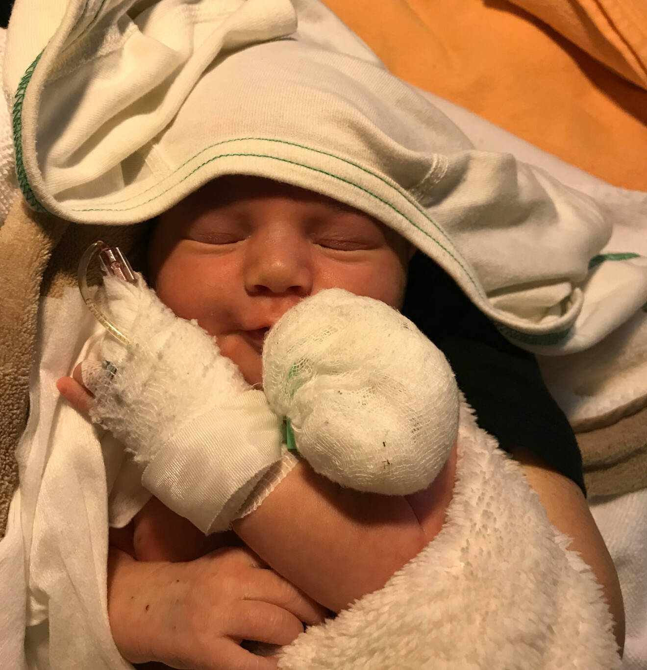 En nyfödd Theodore Andersson ligger insvept i filtar på sjukhuset med kanyl.