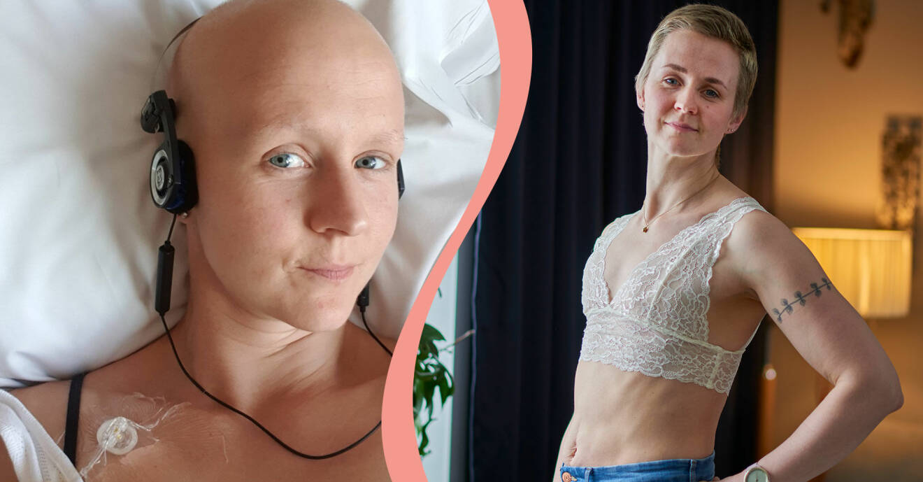 Matilda Lindmark fick kämpa för rätten att bli platt efter bröstcanceroperationen och är nu en av grundarna till föreningen Plattnormen.