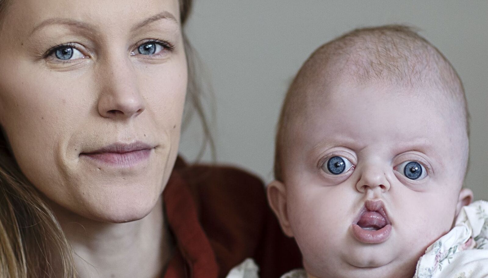 Vigga Har Ovanliga Sjukdomen Aicardi Syndrom Allas vigga-har-ovanliga-sjukdomen-aicardi-syndrom-allas