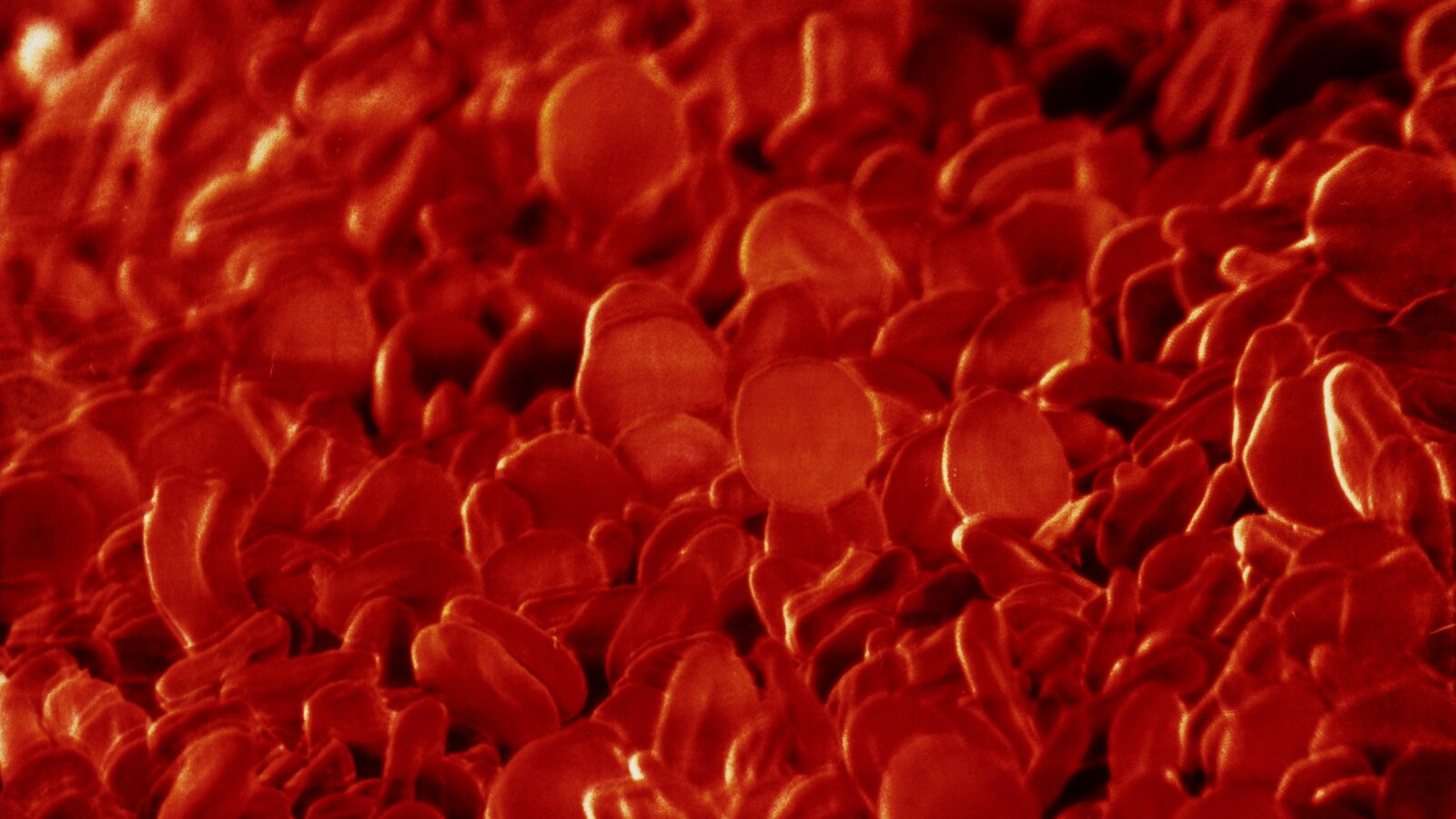 Blodgrupper: Påverkar mitt blod om jag drabbas av corona? | Allas