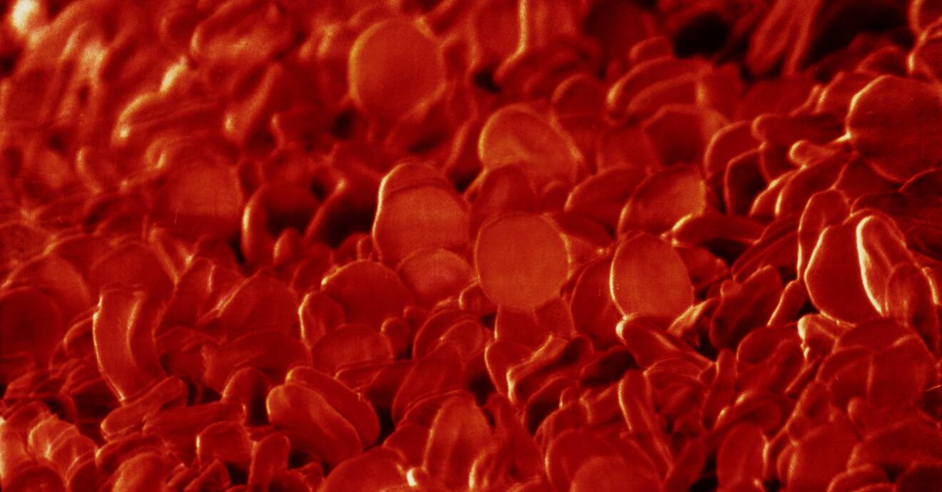 Röda blodceller som på ytan är täckta av olika antigener som A, B, AB eller inga alls.